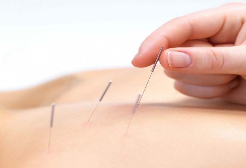 Vibrant Health With Acupuncture GRD Health And Healing